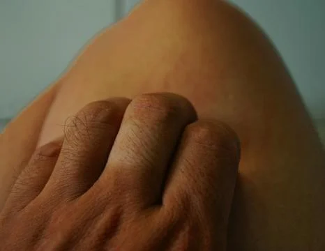 Scratching the leg caused by itching Stock Photos