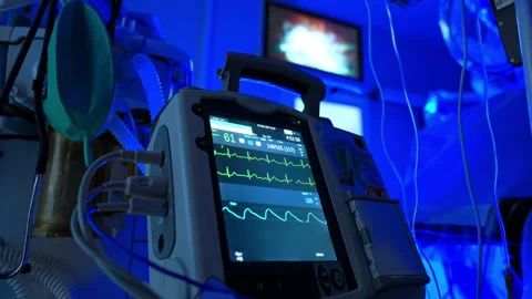 Screen with curved lines displaying the patient condition at operation. Vital Stock Footage 335167898