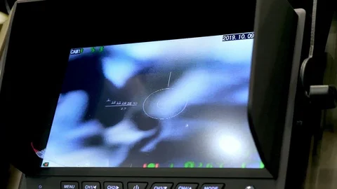 Screen of a infrared thermal camera device with walking people. Stock Footage 117602988