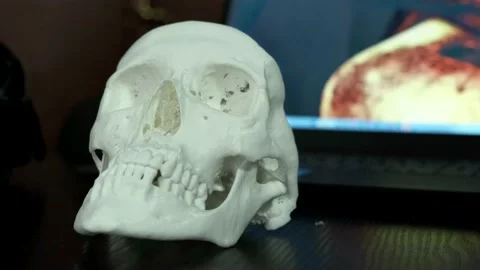 Scull model printed on 3D printer. Modern printing technology Stock Footage 237595264