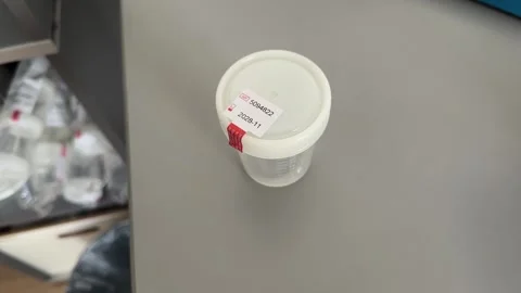 Sealed Urine Sample Cup with Label – Sterile Medical Container Stock Footage 334714311