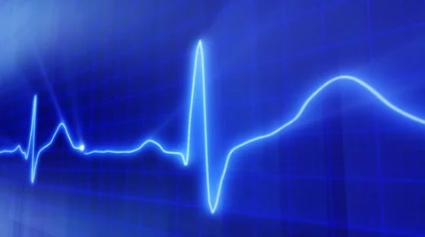 Seamless loop blue background EKG electrocardiogram pulse real waveform Stock Footage 8679099