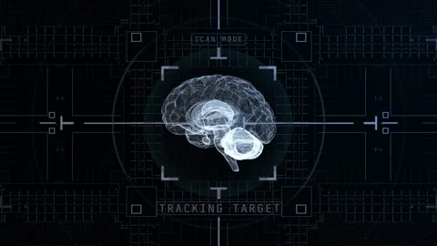 Seamless looping brain MRI scanner tomog... | Stock Video | Pond5