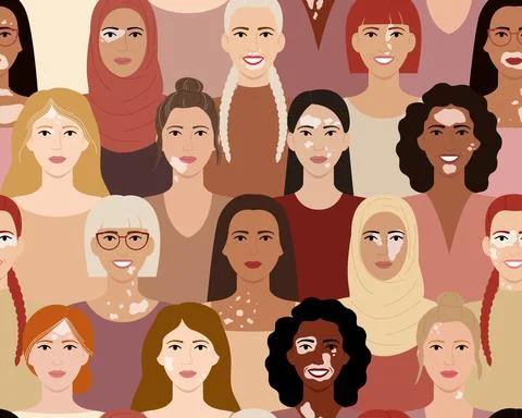 Seamless pattern of female faces with vitiligo. Portraits with different ethn Stock Illustration