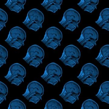 Seamless pattern of MRI scans of sixty years old caucasian female head in Stock Photos