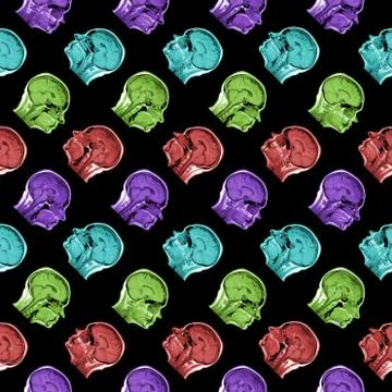 Seamless pattern of MRI scans of sixty years old caucasian female head in Stock Photos
