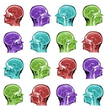 Seamless pattern of MRI scans of sixty years old caucasian female head in Stock Photos