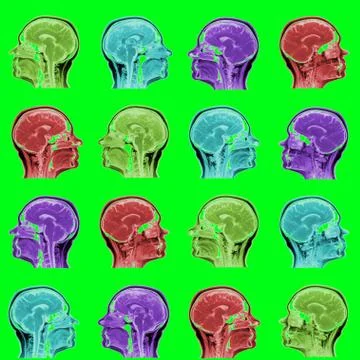 Seamless pattern of MRI scans of sixty years old caucasian female head in Stock Photos