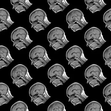 Seamless pattern of sagittal MRI scans of sixty years old caucasian female head Stock Photos