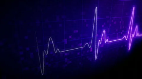 Seamlessly looping EKG heart monitor. HD progressive. Stock Footage
