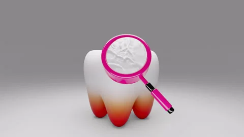 Search for Tooth Decay Stock Footage 314734305