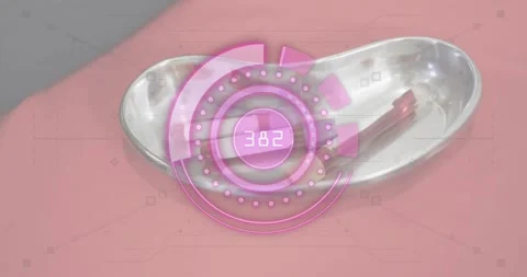 Second counter reaching value activating kidney tray showing pink HUD updating Video stock 318550889