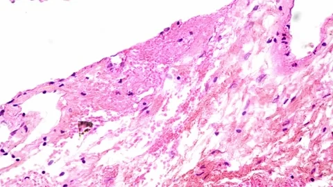 Section of adrenal gland of human being filmed under microscope 400x on bright Stock Footage 244594301