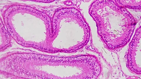 Section of epididymis under microscope magnified in 200 times against bright Stock Footage 225541209