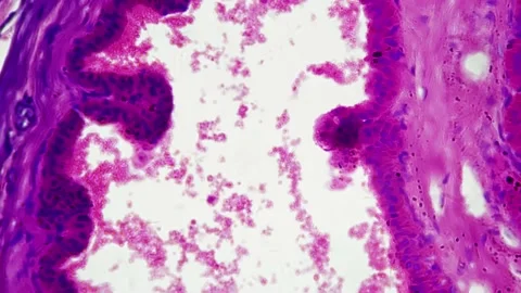 Section of human being prostate gland in high magnification 400x filmed under Stock Footage 226834776