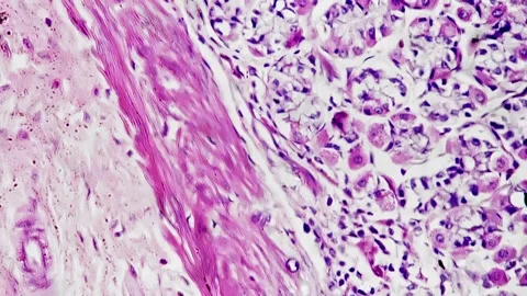 Section of human stomach pattern magnified in 400 times under microscope on Stock Footage 246241990