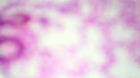 Section lung under the microscope (lungs Sec.), Full HD Stock Footage 47087627