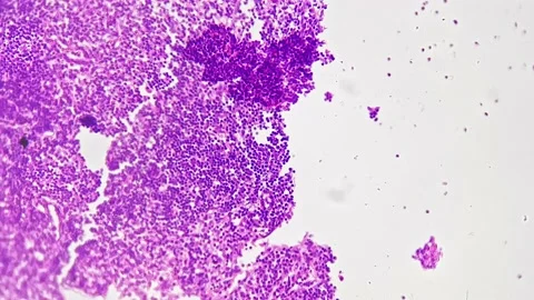 Section of lymph node magnified under microscope in 400x times on bright field Stock Footage 220006861