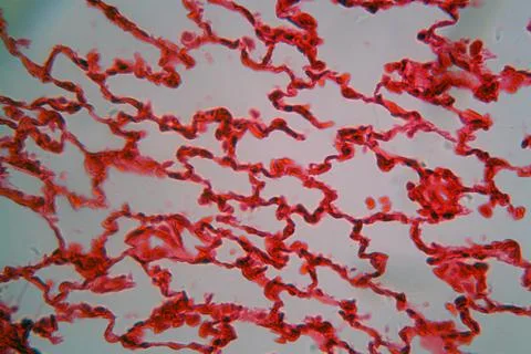 A section trough lungs cells and aveoli under the microscope. Stock Photos