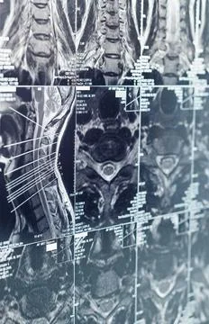 Sectional tomographic image Fotos Stock