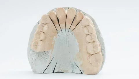 Sectioned dental cast of upper teeth arch Stock Photos