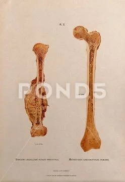 Sections through humerus and femur bones, two figures: the left ...