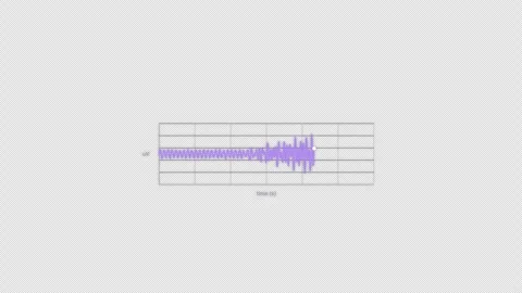 Seizure Onset EEG Brain Wave Animation Clean No Text Video Overlay Alpha 4K Vídeo Stock 339303617