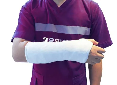Selective focus Close up A Nurse accident and on shot arm white plaster cast  Stock Photos