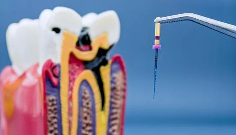 Selective focus on endodontic dental file. Blurred anatomical tooth model sho 写真素材