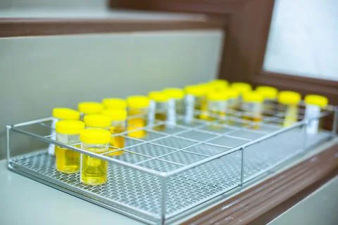 Selective focus to many urine sample bottle, Stock Photos