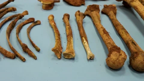 Selective focus on real human bones, femurs, tibiae and fibulae from an arch Stock Footage 145829864