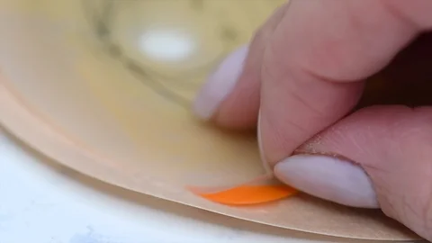 Selective focus on removing foil of adhesive part of colostomy bag.  Video stock 122316602