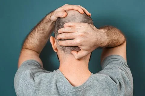 Self-doubt and inferiority complex. Baldy brunette man grabs his head with hi Stock Photos