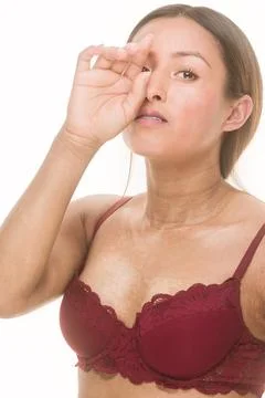 Self-expression Sclerosis unaltered dermatitis skincare. Latin woman lingerie Stock Photos