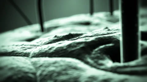 SEM  Scanning Electron Microscope photo of  single human hair and skin. Stock Footage 44559845