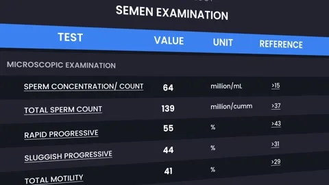 Semen Analysis Laboratory UI Dashboard Medical Examination Animation 4K Video Stock Footage 337238412