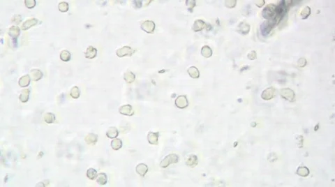 Semen under microscope Stockbeeldmateriaal 270650