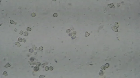 Semen under microscope Stockbeeldmateriaal 270666