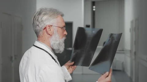 Senior doctor smiling to the camera while examining x-ray scans Stock Footage 137263164