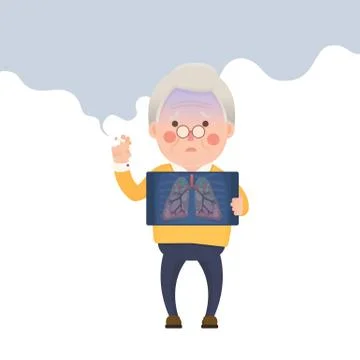 Senior Man Smoking, Lung Problem Illustrazione stock