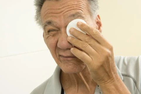 Senior man using cotton pads for eye relief Stock Photos