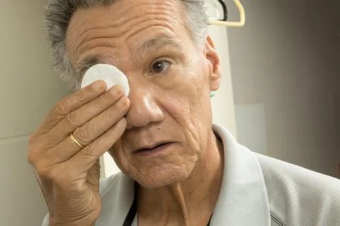 Senior man using cotton pads for eye relief Stock Photos