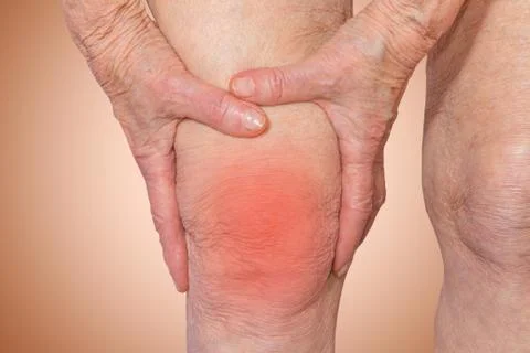Senior woman holding the knee with pain Stock Photos