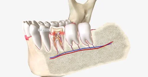Sensitive teeth is a common dental condition characterized by sharp tooth pai Stock Illustration