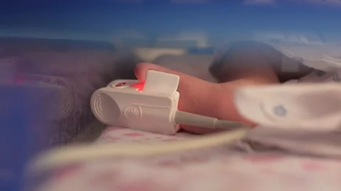 Sensor connected with the foot of a newborn premature baby.intensive care unit Stock Footage 111526410
