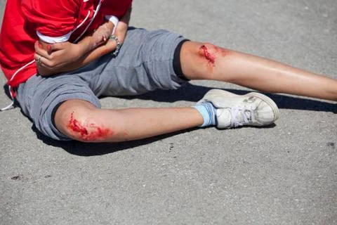 Serious injuries Foto stock