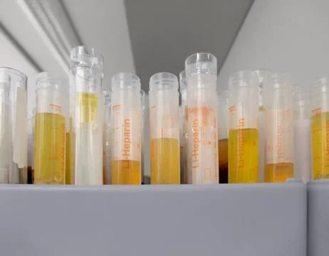 Serologic assays Stock Photos