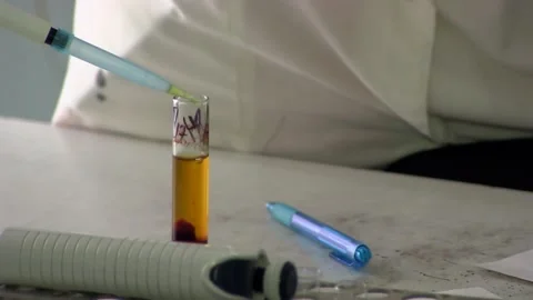 Serum analysis. Coronavirus Video stock 114008745