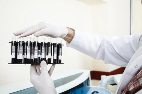 Serum analysis Stock Photos