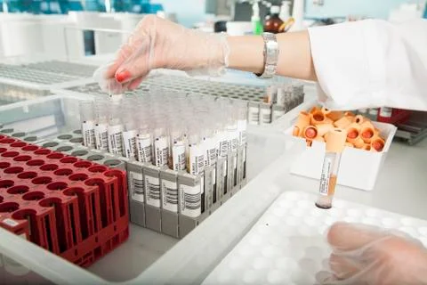 Serum analysis Stock Photos